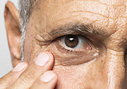 Care After Cataract Surgery: Five Things You Must Do | MM Chokshi Eye Hospital