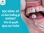 Bọc răng sứ có ảnh hưởng gì không? Yếu tố quyết định an toàn