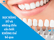 Bọc răng sứ và những điều cần biết không thể bỏ qua