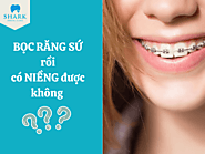 Bọc răng sứ rồi có niềng được không? Có ảnh hưởng gì không?