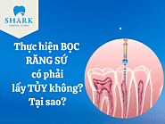 Thực hiện bọc răng sứ có phải lấy tủy không? Tại sao?