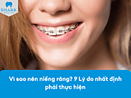 Vì sao nên niềng răng? 9 Lý do nhất định phải thực hiện