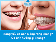 Răng yếu có nên niềng răng không? Có ảnh hưởng gì không?