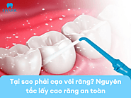 Tại sao phải cạo vôi răng? Nguyên tắc lấy cao răng an toàn