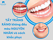 Tẩy trắng răng không đều màu - Nguyên nhân và cách khắc phục