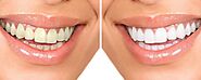 Cosmetic Dentistry in Twin Falls, ID | Green Acres Family Dental