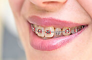 Orthodontics Department - Al Bushara