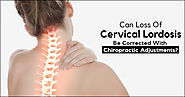 Can Loss Of Cervical Lordosis Be Corrected With Chiropractic Adjustments?