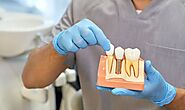 Reclaiming Your Smile: Implant Dentistry Solutions In Lafayette