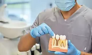How Implant Dentistry Can Improve Your Oral Health