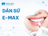 Dịch Vụ Dán sứ Emax - Nha Khoa Shark