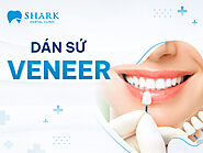 Dịch vụ dán sứ veneer - Nha Khoa Shark