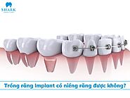 Trồng răng Implant có niềng răng được không, lý do vì sao?