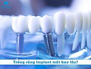 Trồng răng Implant mất bao lâu thời gian thì hoàn thiện?