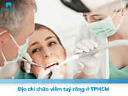 Top 12 địa chỉ chữa viêm tủy răng TPHCM uy tín nhất hiện nay