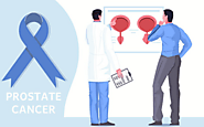 Everything About Prostate Cancer - What Men Should Know