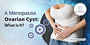 A Menopausal Ovarian Cyst: What Is It? - Dr. Shubhra Goyal
