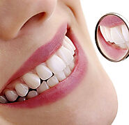 Teeth Whitening Near Me Magnolia, TX - Magnolia Family Dental and Orthodontics