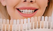 Reveal Your Pearly Whites: Magnolia's Guide To Teeth Whitening Success