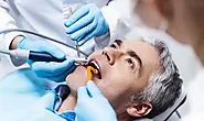 Precision and Comfort: The Modern Approach to Root Canal Therapy in Magnolia