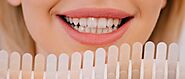 Magnolia’s Smile Secret Revealed: Professional Teeth Whitening Services Now Available