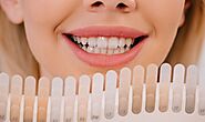 Brighten Your Smile: How Teeth Whitening in Magnolia Can Transform Your Look