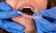 Your Guide To Invisalign Treatment in Beverly Hills