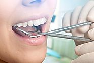 Oakleigh Dentist To Offer The Best Teeth Alignment Treatment