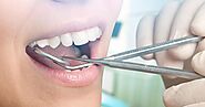 Huntingdale dental clinic: Most common dental issues you need to know about