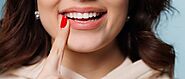 Transform Your Smile with Woodland Dental Center: Leading Cosmetic Dentist in Puyallup – Express Press Release Distri...