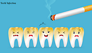 Effects of Smoking on Your Teeth - Teeth Infection