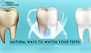 10 Natural ways to Whiten Your Teeth  - Teeth Infection