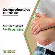 Comprehensive Guide on Ayurveda Treatment for Psoriasis