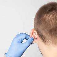 Cosmetic Ear Surgery For Children and Adults | Ear Reshaping Surgery | Otoplasty Cost Dubai