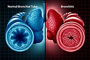 Bronchitis