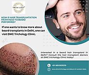 Best Hair Transplant Surgeon in Delhi - DMC Trichology Clinic