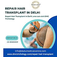 Repair Hair Transplant in Delhi - DMC Trichology