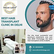 Best Hair Transplant Clinic in Delhi - DMC Trichology