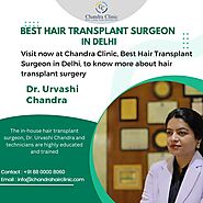 Best Hair Transplant Surgeon in Delhi - Chandra Clinic