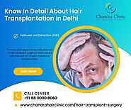 Know In Detail About Hair Transplantation in Delhi