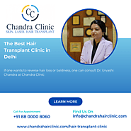 The Best Hair Transplant Clinic in Delhi - Chandra Clinic
