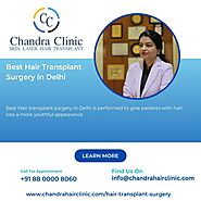 Best Hair Transplant Surgery in Delhi - Chandra Clinic