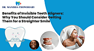 Benefits of Invisible Teeth Aligners: Why You Should Consider Getting Them for a Straighter Smile 
