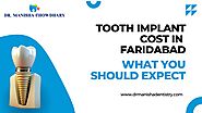Tooth Implant Cost in Faridabad, India | Procedure & Benefits