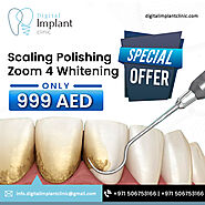 Digital Implant Clinic - The Most Trusted Dental Clinic in Dubai