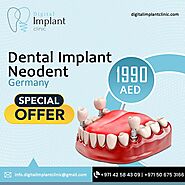 Dental Implant Neodent and Significance of Dental Implant