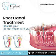 Get Pain-Free Root Canal Treatment in Dubai at the Best Clinic!