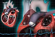 Not a Normal Heart Rhythm or Rate