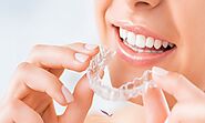 Teeth Braces Cost in India: Transform Smile at The Dental Roots