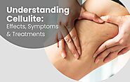 Understanding Cellulite: Effects, Symptoms & Treatments